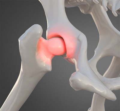 Figyelem ! ÚJRA ! HD szűrés támogatással